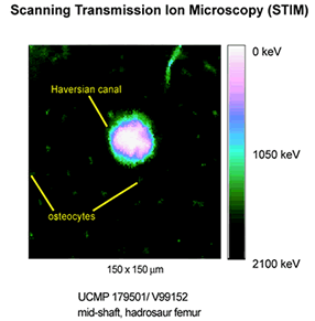 STIM microprobe image