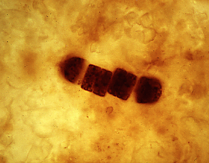 Fossil Record of the Cyanobacteria