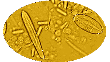 Nematocysts of a Cubozoan