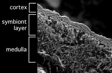 foliose lichen under microscope